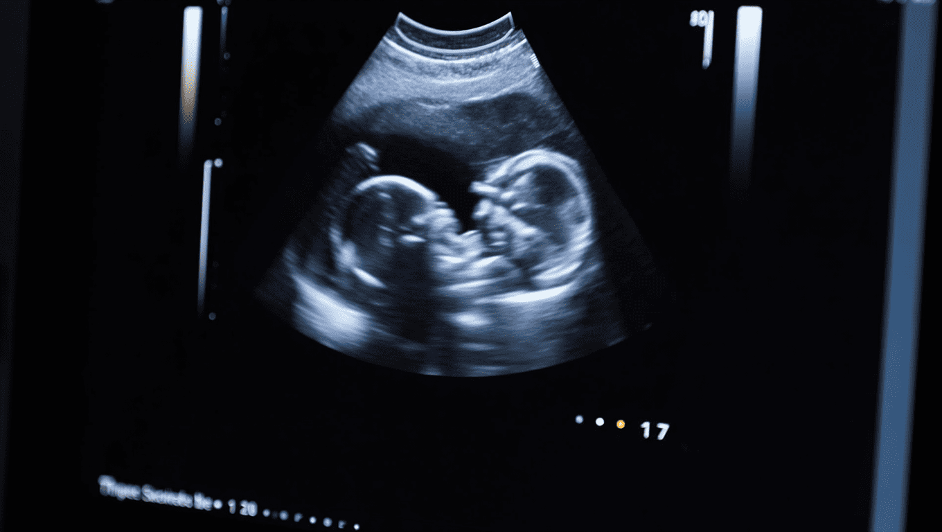 Échographie 12 semaines | Le guide pour tout savoir